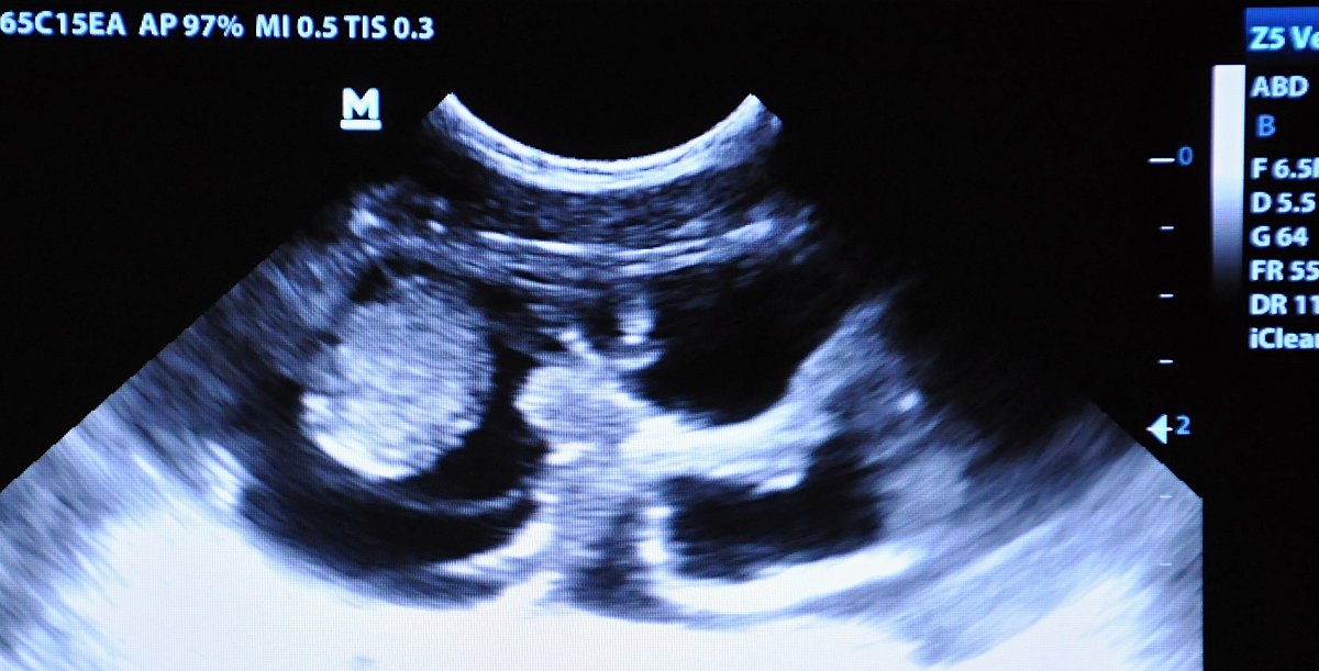 Foto 2_ultrazvuk.jpg