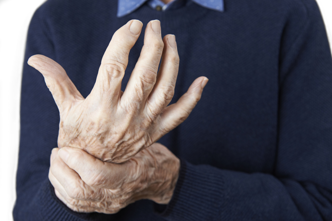 Na biologickou léčbu má nárok více nemocných revmatoidní artritidou