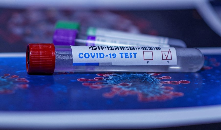 Antigenní testy, kterými chce ministr Prymula testovat českou populaci, nejsou spolehlivé, tvrdí studie