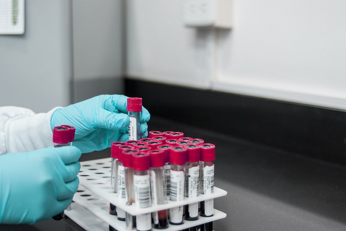 Pokud se obáváte nákazy hepatitidou A, dojděte si raději na testy